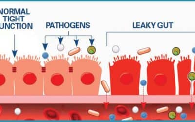 HEALING LEAKY GUT NATURALLY